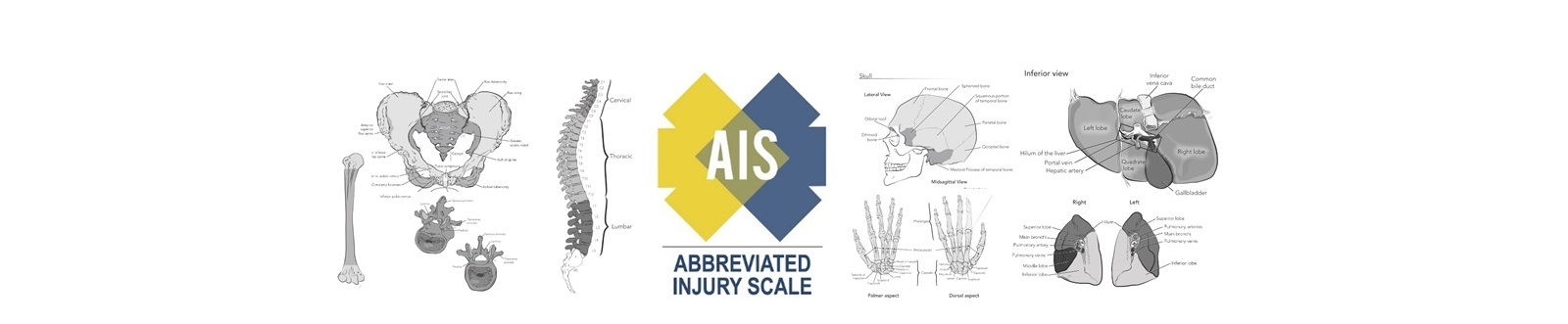 Frequency of various Abbreviated Injury Scale (AIS) scores